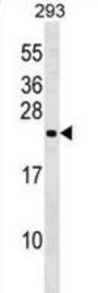 N-6-Adenine Specific DNA Methyltransferase 1 (N6AMT1) Antibody
