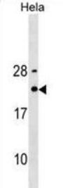Translationally-Controlled Tumor Protein (TPT1) Antibody