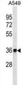 Malate Dehydrogenase 2 (MDH2) Antibody