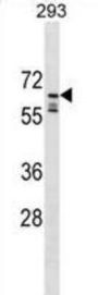 RING-type E3 Ubiquitin Protein Ligase PPIL2 (PPIL2) Antibody