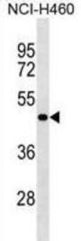 Sphingosine-1-Phosphate Phosphatase 2 (SGPP2) Antibody
