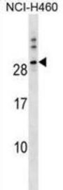 Protein Tweety Homolog 1 (TTYH1) Antibody