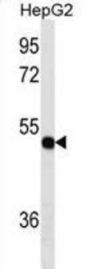 Thioredoxin Domain-Containing Protein 5 (TXNDC5) Antibody