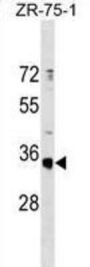OR51G1 Antibody