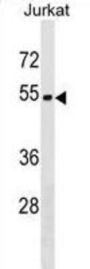 Zinc Finger Protein 703 (ZNF703) Antibody