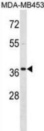 MEOX2 Antibody