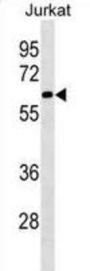 SLU7 Antibody