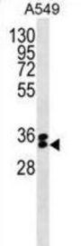 FBXO44 Antibody