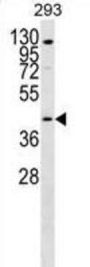 Solute Carrier Family 52, Riboflavin Transporter, Member 1 (GPR172B) Antibody