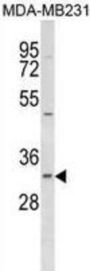 Fumarylacetoacetate Hydrolase Domain-Containing Protein 2B (FAHD2B) Antibody