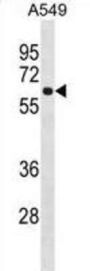 Fc Receptor-Like Protein 1 (FCRL1) Antibody
