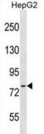 CTEN Antibody