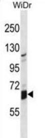 Beta-Galactosidase-1-Like Protein (GLB1L) Antibody