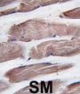 Phosphatidylinositol 3-Kinase Catalytic Subunit Type 3 (PI3KC3) Antibody