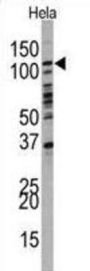Phosphatidylinositol 3-Kinase Catalytic Subunit Type 3 (PI3KC3) Antibody