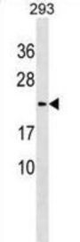 Lysozyme-Like Protein 1 (LYZL1) Antibody