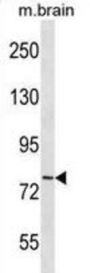 Cadherin 11 (CDH11) Antibody