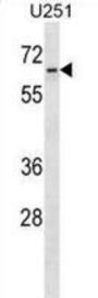 Zinc Finger Protein 768 (ZNF768) Antibody