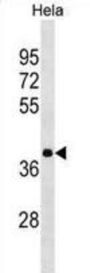 Heterogeneous Nuclear Ribonucleoprotein A3 (HNRNPA3) Antibody