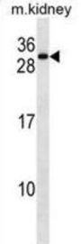 Receptor Accessory Protein 5 (REEP5) Antibody