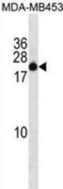 Zinc Finger Protein 747 (ZNF747) Antibody