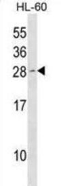 Mouse Cdkn1b Antibody