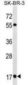 Ras-Related Protein Rab-19 (RAB19) Antibody