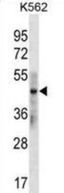 Keratin 33B (KRT33B) Antibody