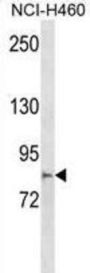 Multiple C2 And Transmembrane Domain Containing 2 (MCTP2) Antibody