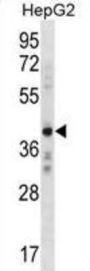 Zinc Finger Protein AEBP2 (AEBP2) Antibody