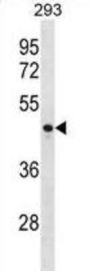 Cyclin-J (CCNJ) Antibody