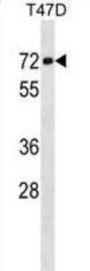 GMCL1L Antibody
