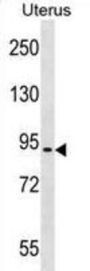 Protein Asteroid Homolog 1 (ASTE1) Antibody