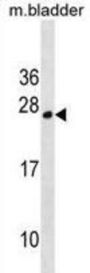TPD52L1 Antibody