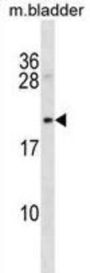 Protein B-Myc (Mycb) Antibody