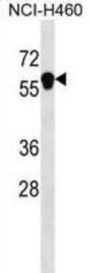 ANKDD1B Antibody