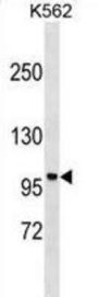 Neurabin 1 (PPP1R9A) Antibody