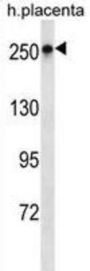 Protein Scribble Homolog (SCRIB) Antibody