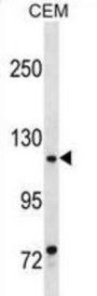MKL1 Antibody