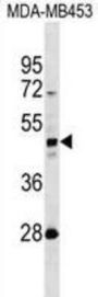 Keratin 31 (KRT31) Antibody
