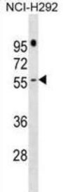 PRAME Family Member 16 (PRAMEF16) Antibody