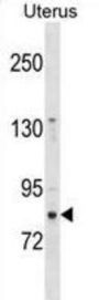 Zinc Finger Protein 853 (ZNF853) Antibody