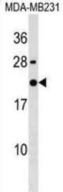 IMA2L Antibody