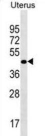 Proline-Rich Protein 25 (PRR25) Antibody
