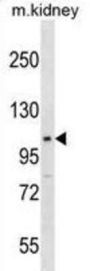 Signal Transducer And Activator of Transcription 2 (Stat2) Antibody