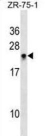 Ras Homolog Family Member H (RHOH) Antibody
