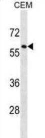 TRIM58 Antibody