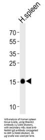 Non-Secretory Ribonuclease (RNASE2) Antibody