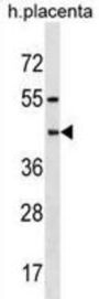 Pregnancy-Specific Beta-1-Glycoprotein 6 (PSG6) Antibody