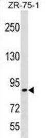 RAS P21 Protein Activator 3 (RASA3) Antibody